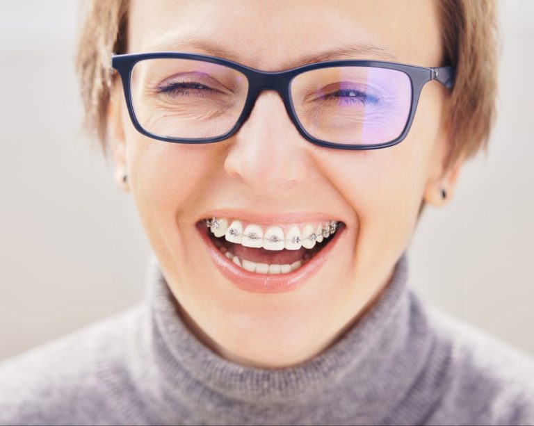 Can Adults Get Orthodontic Treatment? Carmel Orthodontists