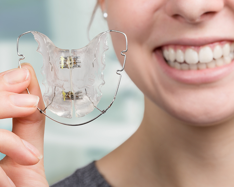 Orthodontic retainers from Carmel IN orthodontists